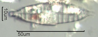 Denticula spp.